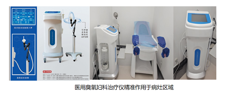 妇科臭氧冲洗怎么洗【科室业务】妇科肿瘤放疗的“必修课” 不可或缺的阴道冲洗——守护您的康复之路 从每一次规范冲洗开始_https://www.jmylbn.com_新闻资讯_第1张